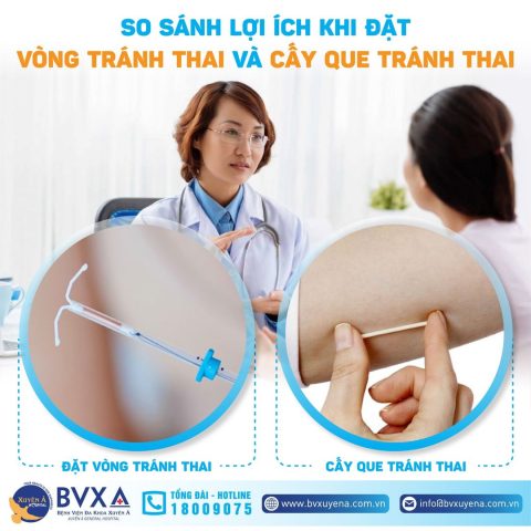 Các phương pháp tránh thai nội tiết hiện đại