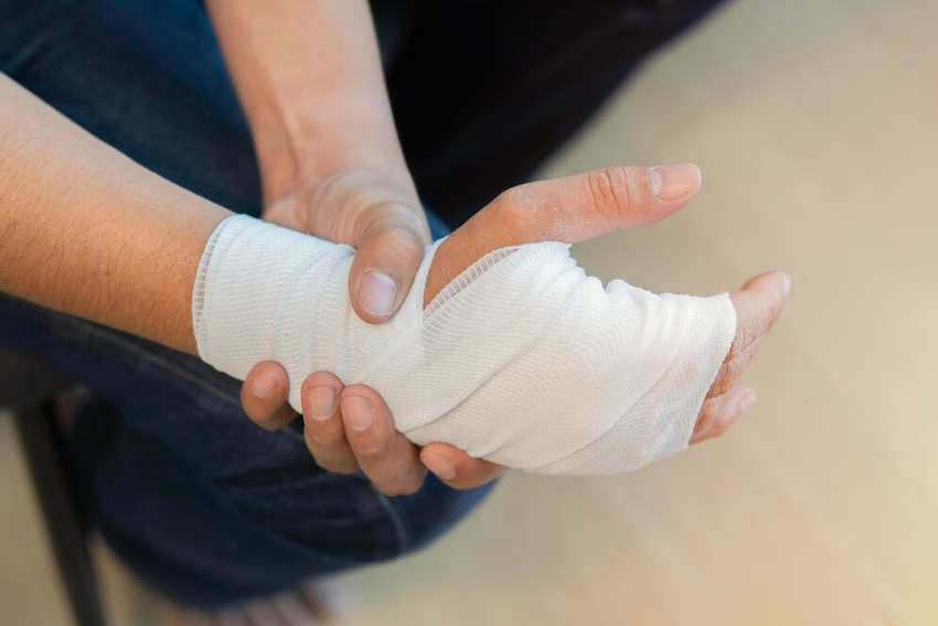 Băng Bó Cổ Tay Đúng Cách: Hướng Dẫn Chi Tiết Từ A-Z Để Phục Hồi Hiệu Quả