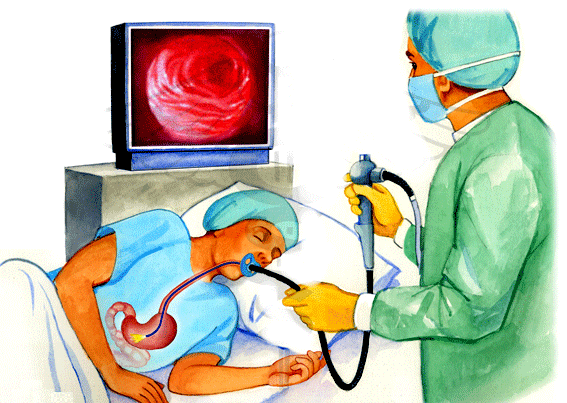 Nội soi dạ dày khi đang dùng thuốc: Hướng dẫn chi tiết và lời khuyên