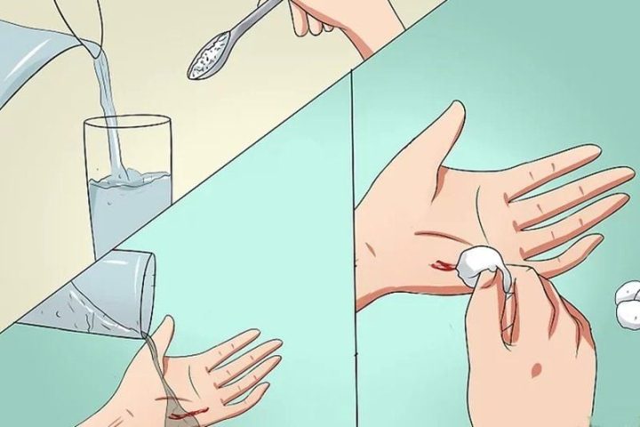 Thuốc Giảm Đau Khi Ngã 4m Đập Mông Xuống Đất: Hướng Dẫn Y Tế Quan Trọng
