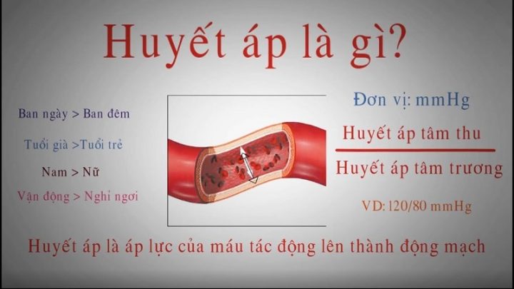 Các loại máy đo huyết áp và cách hoạt động