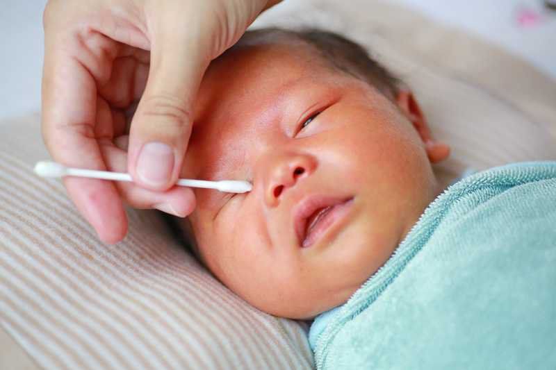 Thuốc Mỡ Tra Mắt Dùng Cho Trẻ Nhỏ: Khi Nào An Toàn Và Cần Lưu Ý