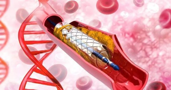 Thuốc Chống Kết Tập Tiểu Cầu Và Thuốc Kháng Đông: Phân Tích Chuyên Sâu
