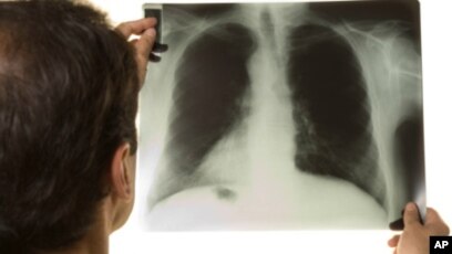 Thuốc Dự Phòng Lao Cho Trẻ 0 Đến 4 Tuổi: Hướng Dẫn Chi Tiết Và An Toàn