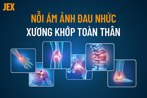 Bài Thuốc Dân Gian Chữa Đau Nhức Xương Khớp Hiệu Quả Tận Gốc