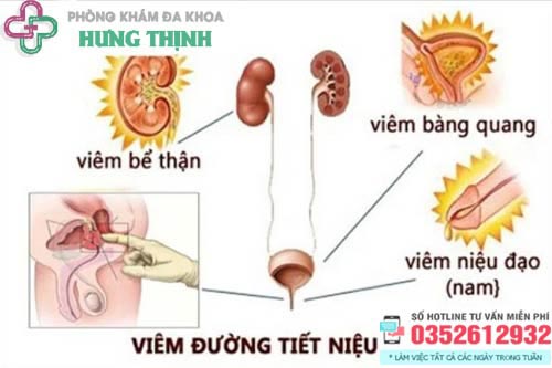 Thuốc điều trị viêm đường tiết niệu ở nam giới hiệu quả