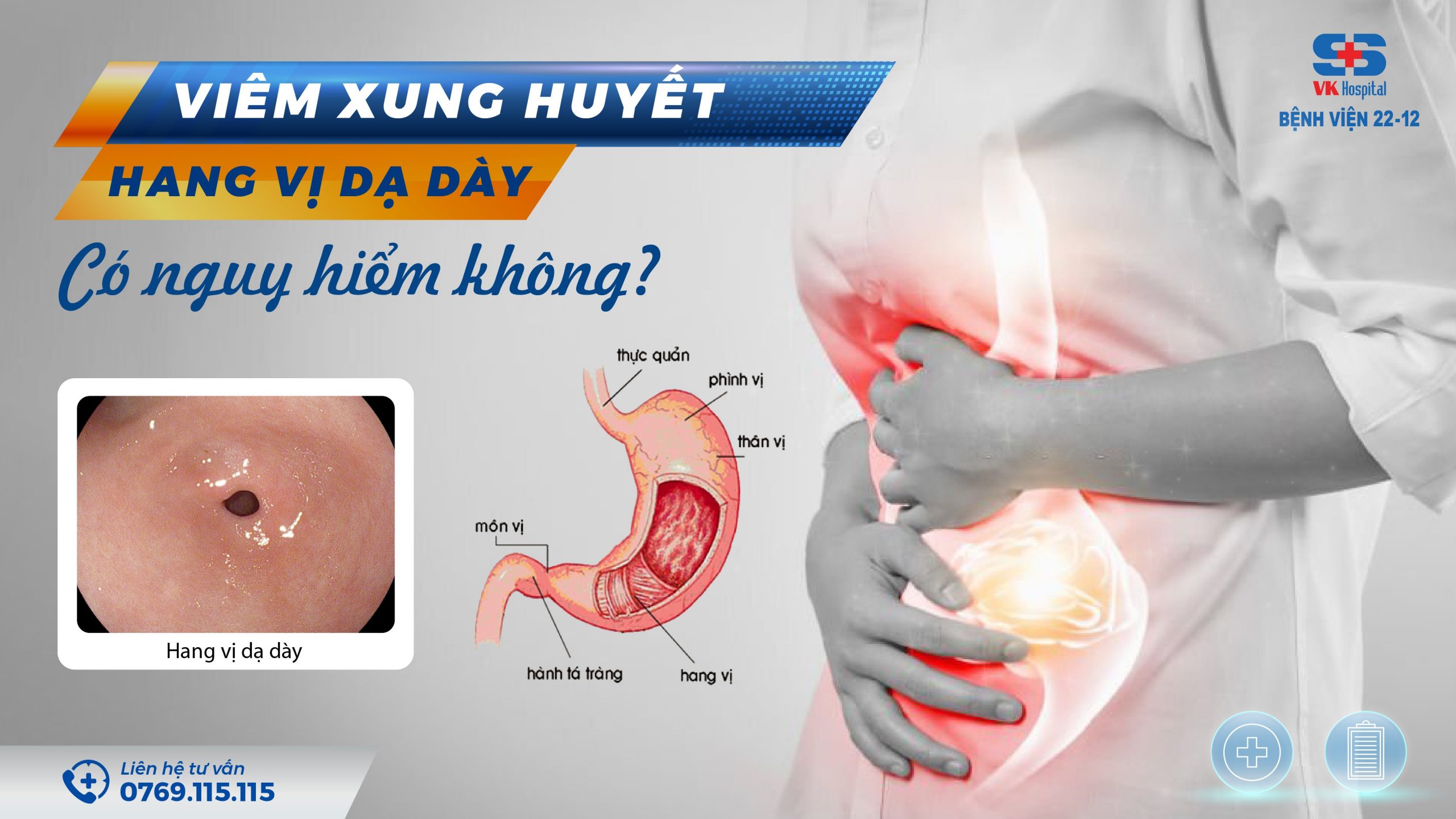 Thuốc Điều Trị Viêm Xung Huyết Hang Vị Dạ Dày Hiệu Quả Và An Toàn