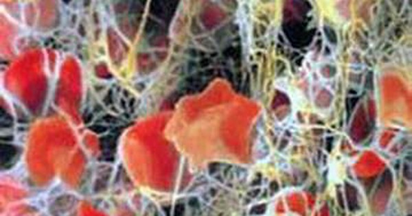Sản phẩm Thương mại Thuốc Chống Đông Máu từ Staphylokinase: Tiềm năng và Ứng dụng