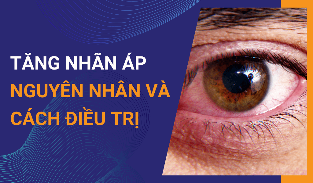 Tăng Áp và Phác Đồ Điều Trị: Hướng Dẫn Toàn Diện Từ A-Z