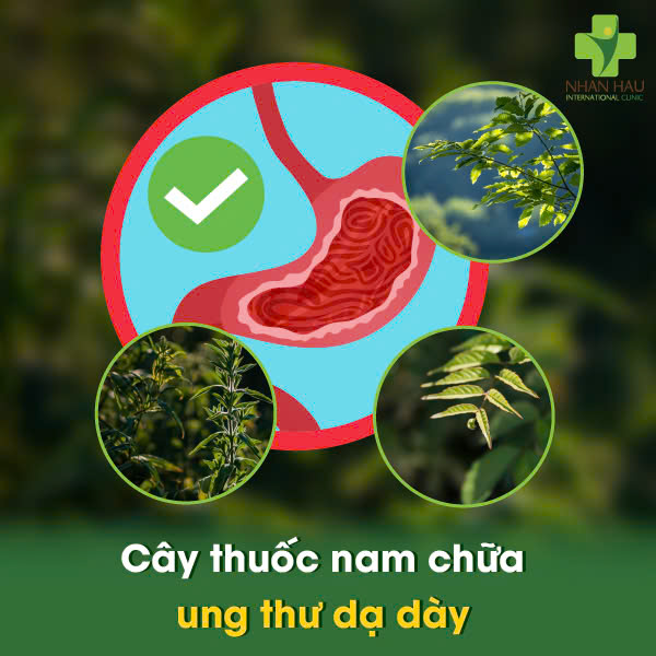 Thuốc Ức Chế Bơm Proton Gây Ung Thư Dạ Dày: Sự Thật Cần Biết