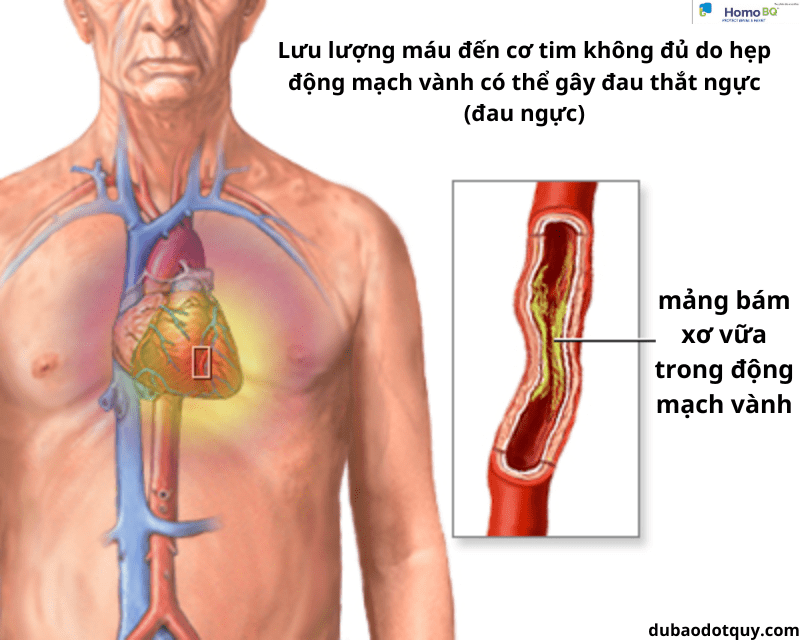 Cơ Chế Giãn Mạch Vành Của Thuốc Ức Chế Men Chuyển Cơ Chế Giãn Mạch Vành Của Thuốc Ức Chế Men Chuyển