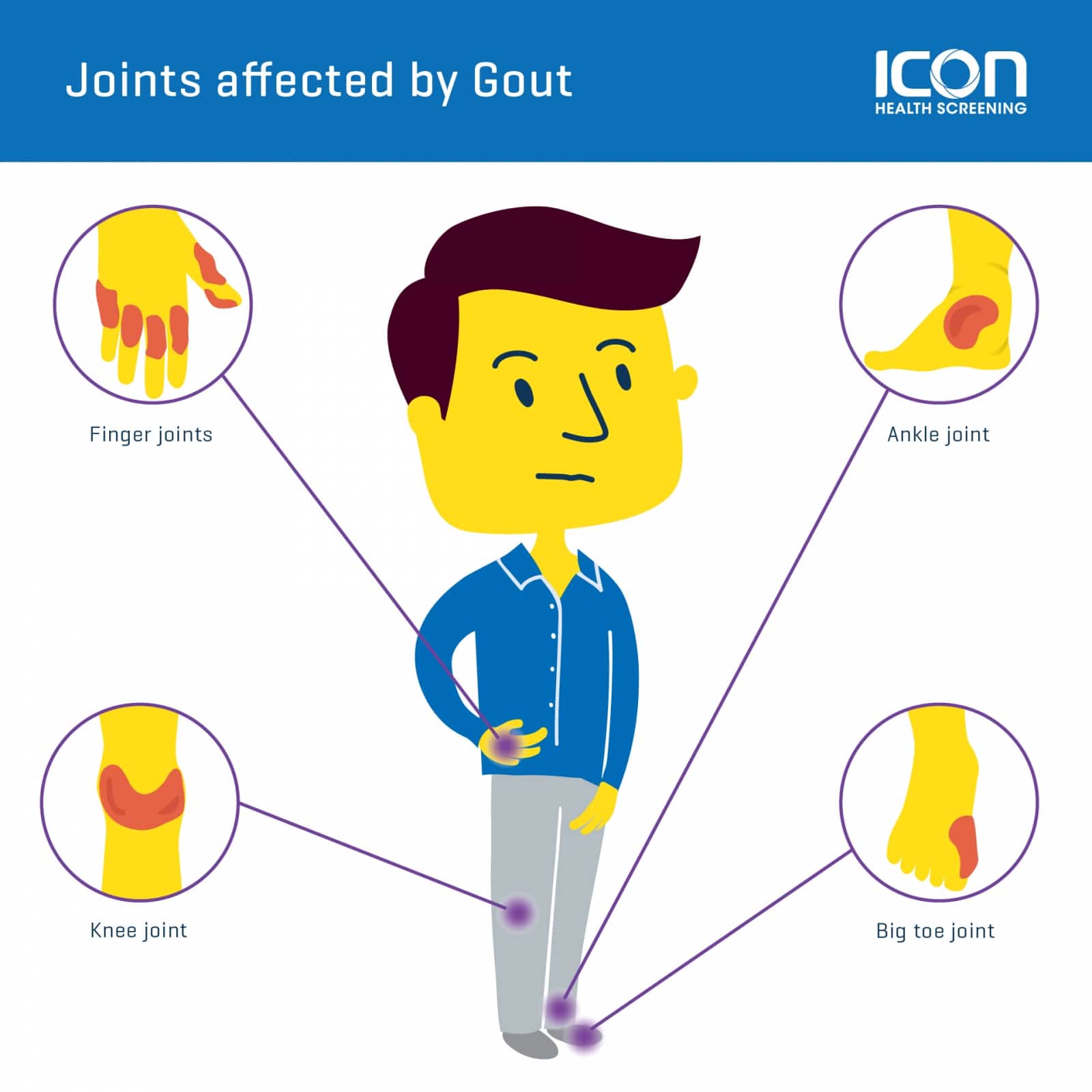 Các Loại Thuốc Chính Gây Gout Thứ Phát Ở Phụ Nữ: Tổng Quan Chi Tiết Các Loại Thuốc Chính Gây Gout Thứ Phát Ở Phụ Nữ: Tổng Quan Chi Tiết