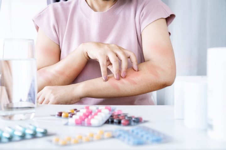 Dị Ứng Thuốc Gây Khó Thở: Nguyên Nhân, Triệu Chứng Và Cách Xử Lý