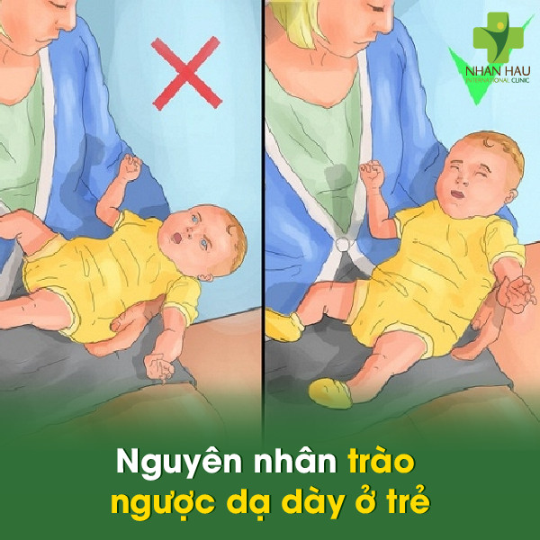 Thuốc Chữa Trào Ngược Dạ Dày Ở Trẻ Sơ Sinh: Lựa Chọn An Toàn
