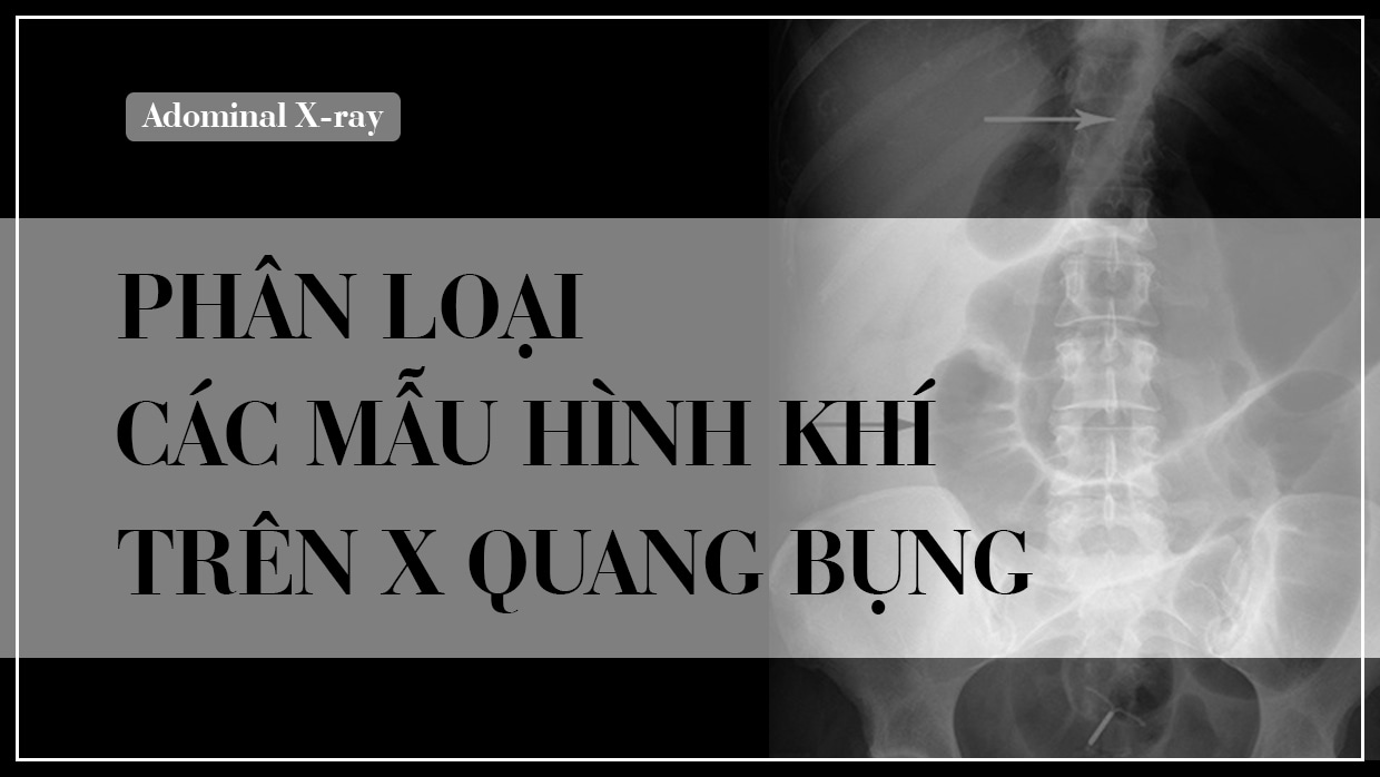 Hướng dẫn đọc phim X-quang dạ dày có thuốc chuyên sâu