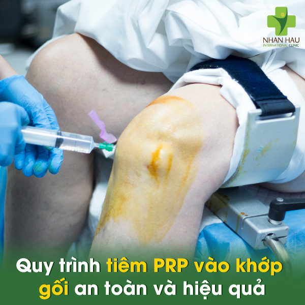 Khi Làm PRP Khớp Gối, Không Nên Uống Thuốc Nào Để Đảm Bảo Hiệu Quả?