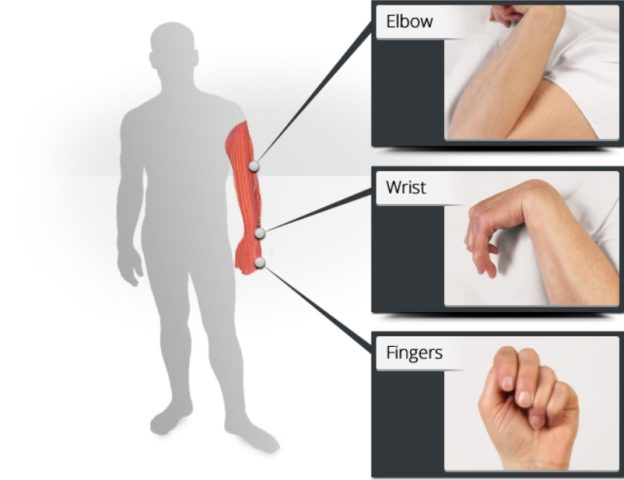 Thuốc Chữa Co Rút Cơ Sau Tai Biến: Hướng Dẫn Toàn Diện