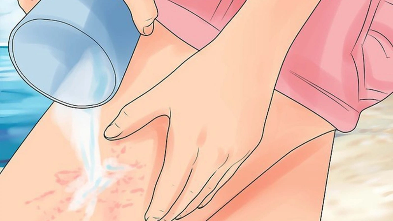 Bôi Thuốc Mỡ Vào Vết Thương Hở Do Sứa Cắn: Hướng Dẫn Chi Tiết Và An Toàn