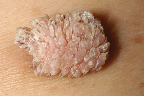 Thuốc Giảm Cân Filiform Mua Ở Đâu Tại TP.HCM: Hướng Dẫn Toàn Diện