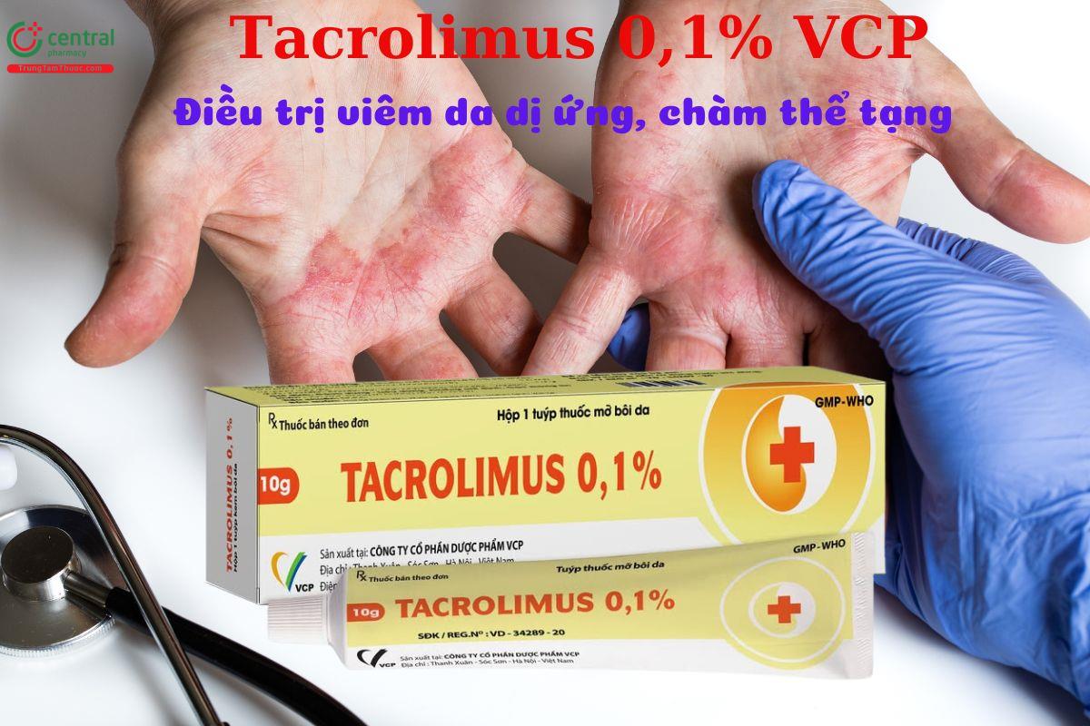Thuốc Kcor và liệu pháp tiêm cho viêm da cơ địa: Thông tin cần biết Thuốc Kcor và liệu pháp tiêm cho viêm da cơ địa: Thông tin cần biết
