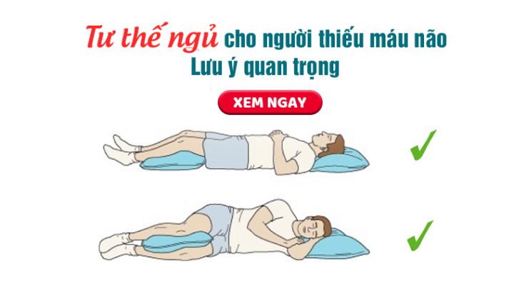 Các tư thế ngủ đúng chuẩn hỗ trợ người bệnh thiếu máu não giảm triệu chứng và tăng cường sức khỏe