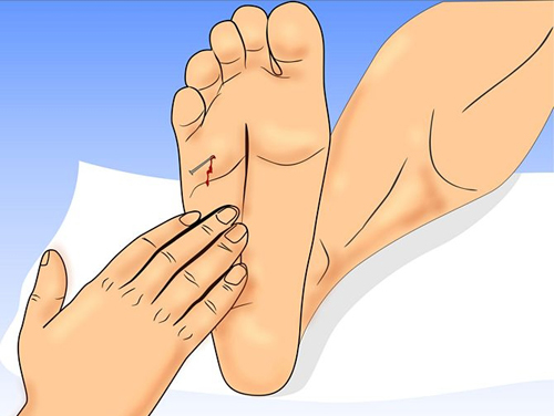 Chân Đạp Đinh Sét Cần Chích Thuốc Ngừa Uốn Ván Và Cách Xử Lý Đúng Chuẩn