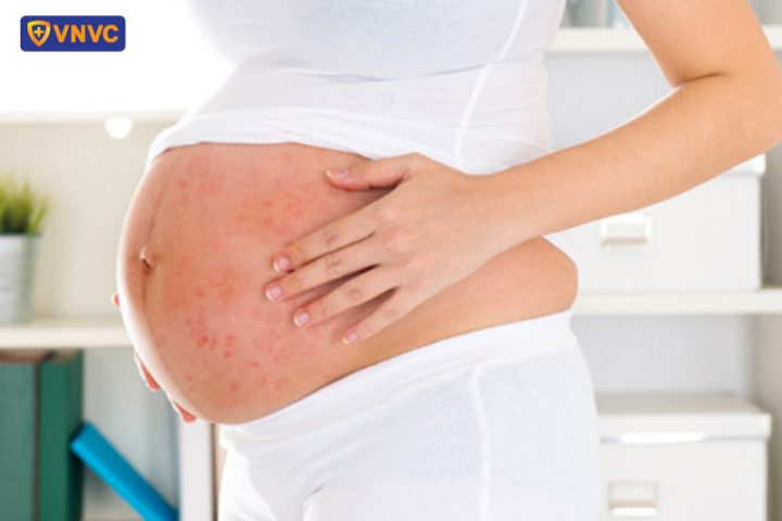 Thuốc Chữa Zona Thần Kinh An Toàn Cho Phụ Nữ Mang Thai Thuốc Chữa Zona Thần Kinh An Toàn Cho Phụ Nữ Mang Thai