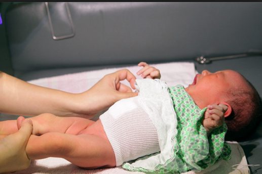 Băng Rốn Sơ Sinh: Hướng Dẫn Chăm Sóc Đúng Cách và An Toàn