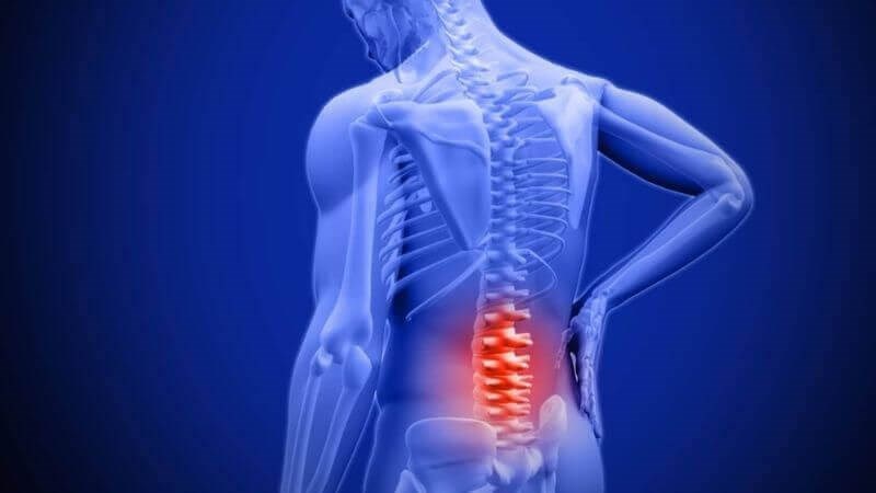 Thuốc Điều Trị Thoái Hóa Đốt Sống Lưng Của Úc: Giải Pháp Toàn Diện