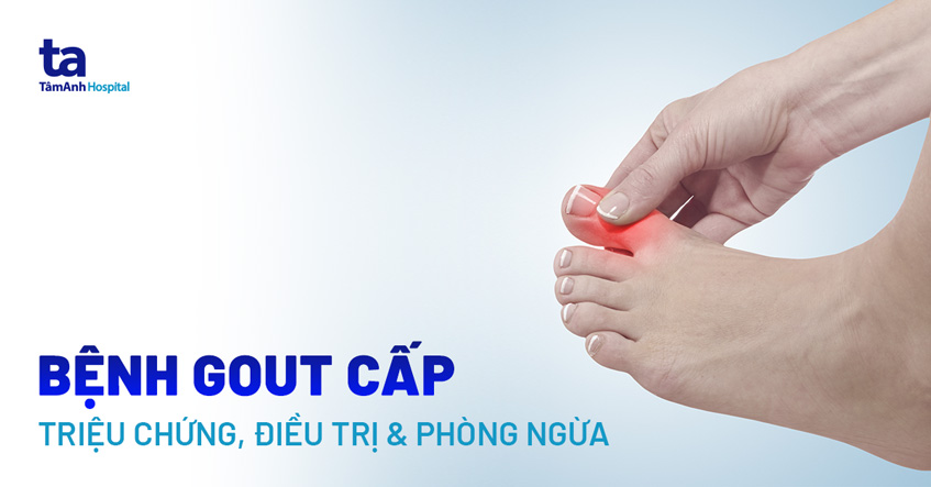 Khi Cơn Đau Gout Cấp: Lựa Chọn Thuốc Tây Điều Trị Hiệu Quả Khi Cơn Đau Gout Cấp: Lựa Chọn Thuốc Tây Điều Trị Hiệu Quả