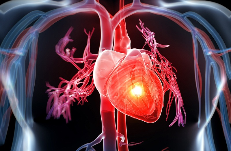 Phối hợp Heparin với hai thuốc chống tiểu cầu trong điều trị tim mạch