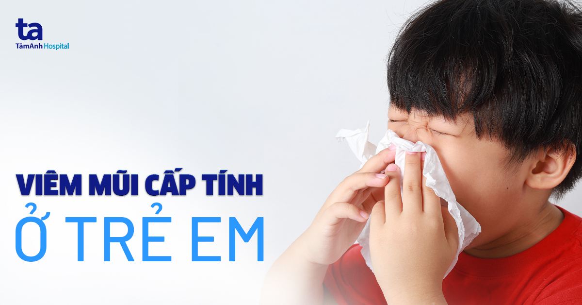 Viêm Mũi Cấp: Nguyên Nhân, Triệu Chứng, Cách Điều Trị Hiệu Quả Viêm Mũi Cấp: Nguyên Nhân, Triệu Chứng, Cách Điều Trị Hiệu Quả