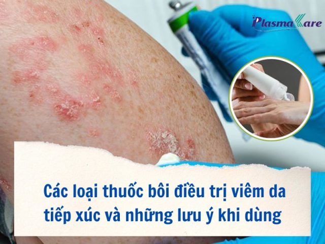 Các Vị Thuốc Đông Y Điều Trị Viêm Da Tiếp Xúc Hiệu Quả