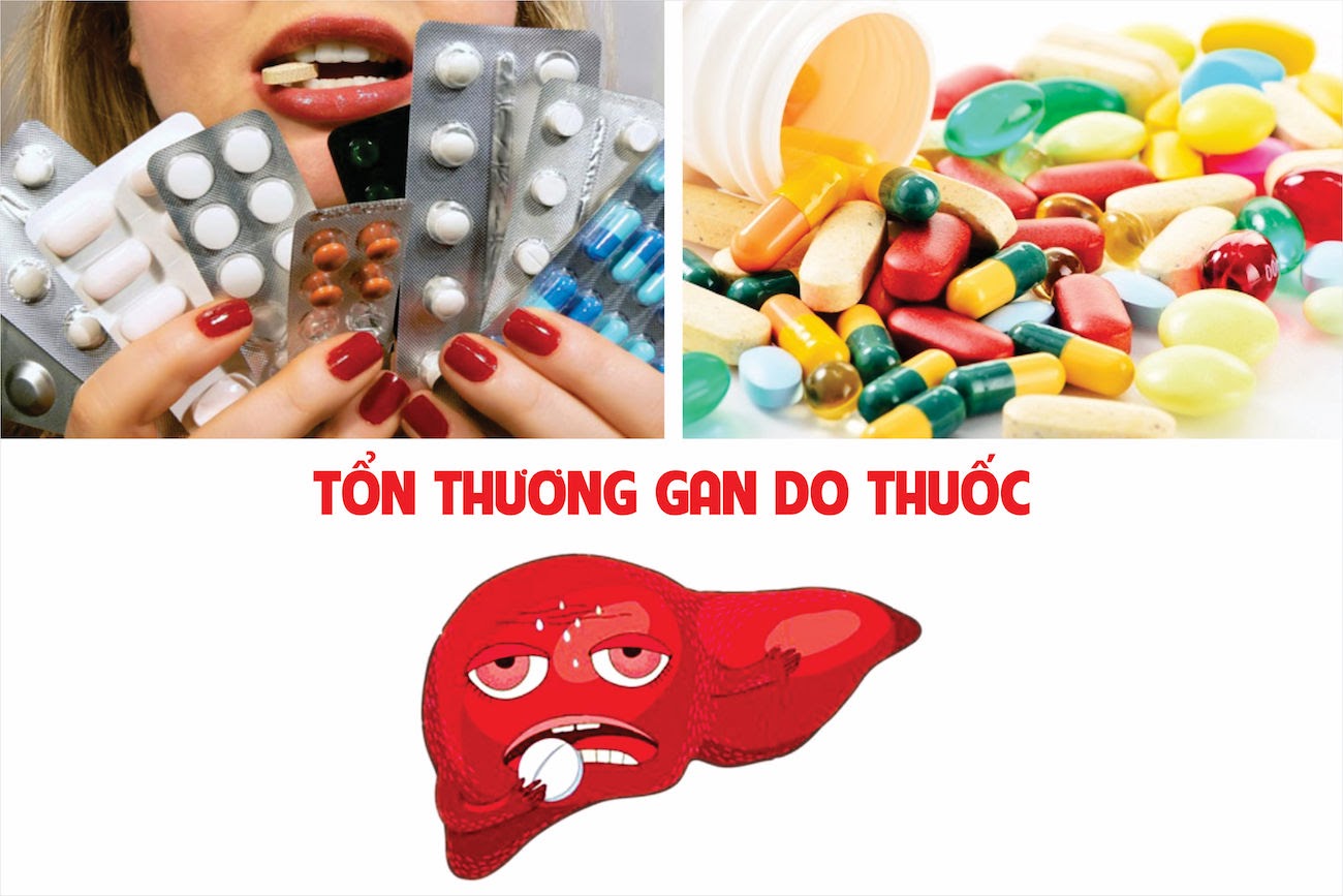 Tác dụng phụ gây nôn mửa của thuốc giảm đau: Nguyên nhân và cách xử lý