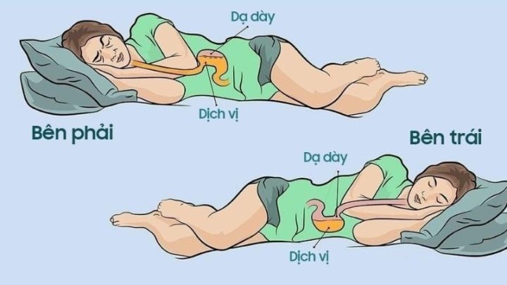 Tổng hợp các tư thế ngủ khoa học được khuyến nghị để cải thiện tình trạng thiếu máu não, bao gồm nằm ngửa và nằm nghiêng