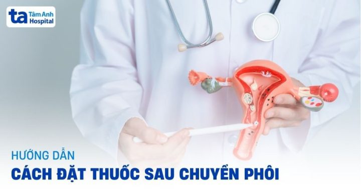 Cơ chế đặt thuốc âm đạo và vị trí tác động bên trong cơ thể
