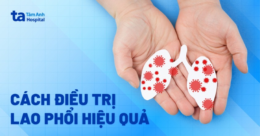 Thuốc Chữa Bệnh Lao Chứa Azometin: Ứng Dụng Quan Trọng Trong Điều Trị