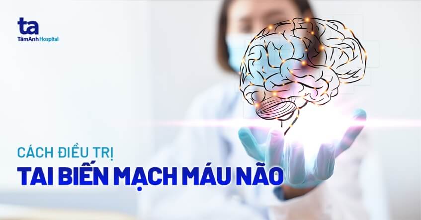 Thuốc Hỗ Trợ Điều Trị Tai Biến Mạch Máu Não: Tổng Quan Chuyên Sâu