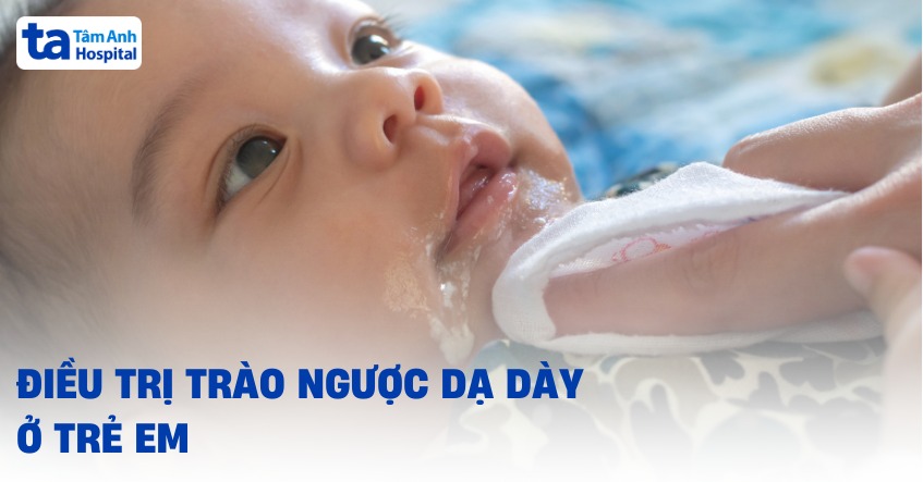 Thuốc Chữa Trào Ngược Dạ Dày Ở Trẻ Sơ Sinh: Lựa Chọn An Toàn