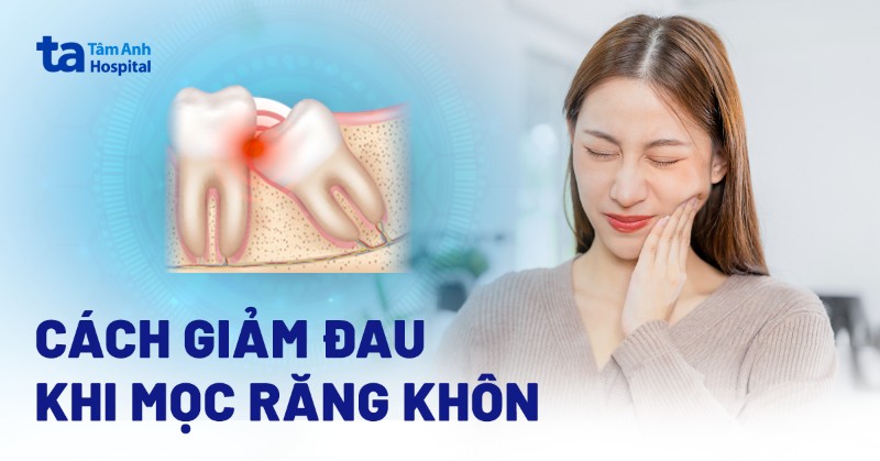 Uống Thuốc Giảm Đau Khi Mọc Răng Khôn: Hướng Dẫn Chi Tiết