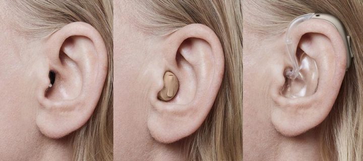 Thiết Bị Trợ Thính: Giải Pháp Toàn Diện Nâng Cao Chất Lượng Cuộc Sống
