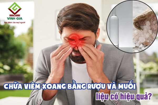 Trị Viêm Xoang Bằng Muối Và Rượu: Hướng Dẫn Chi Tiết A-Z