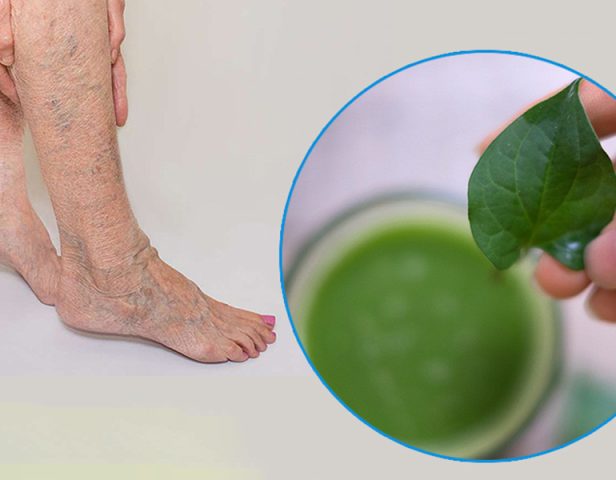 Rau Diếp Cá Trị Giãn Tĩnh Mạch: Hiệu Quả và Hướng Dẫn Chi Tiết