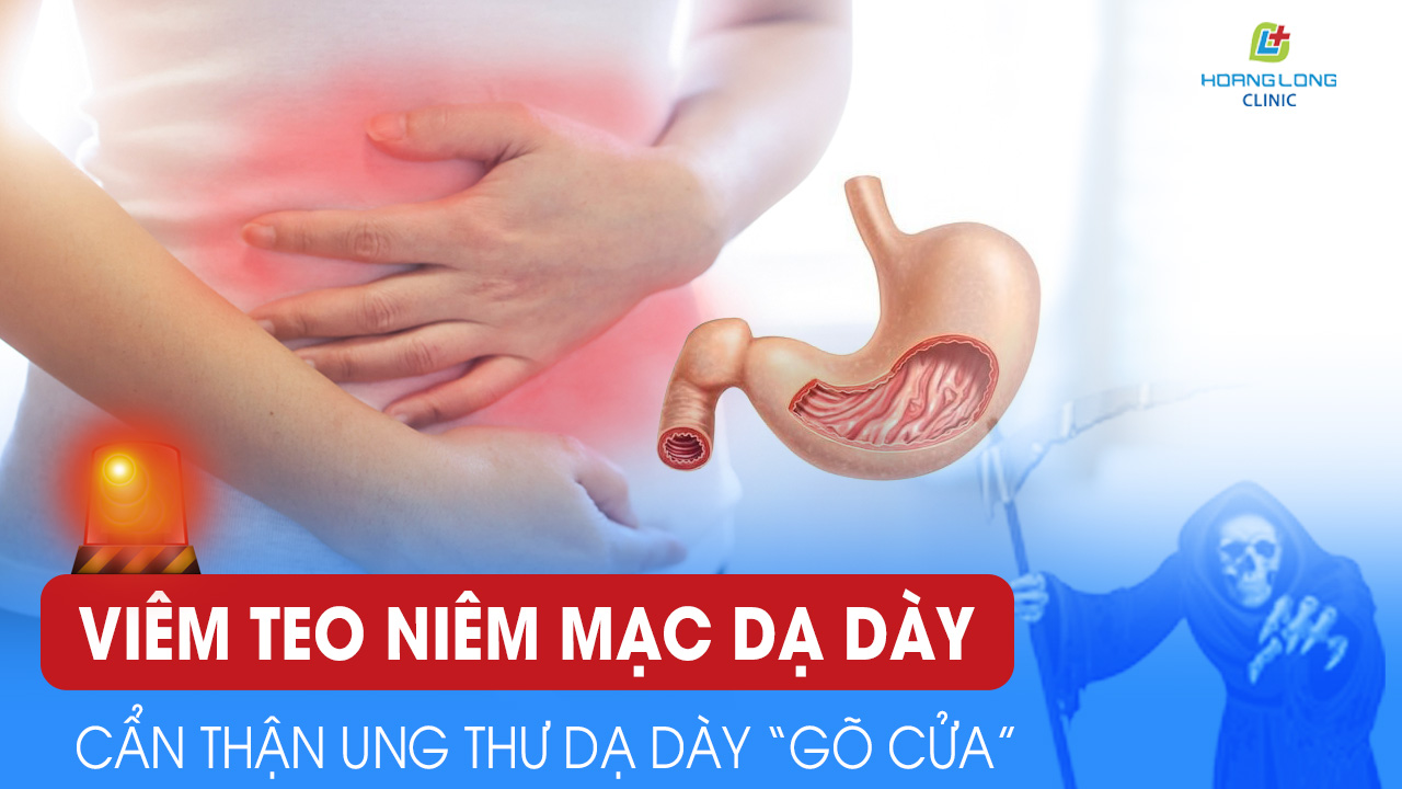 Chữa Bệnh Teo Niêm Mạc Dạ Dày Bằng Thuốc Nam Hiệu Quả và An Toàn
