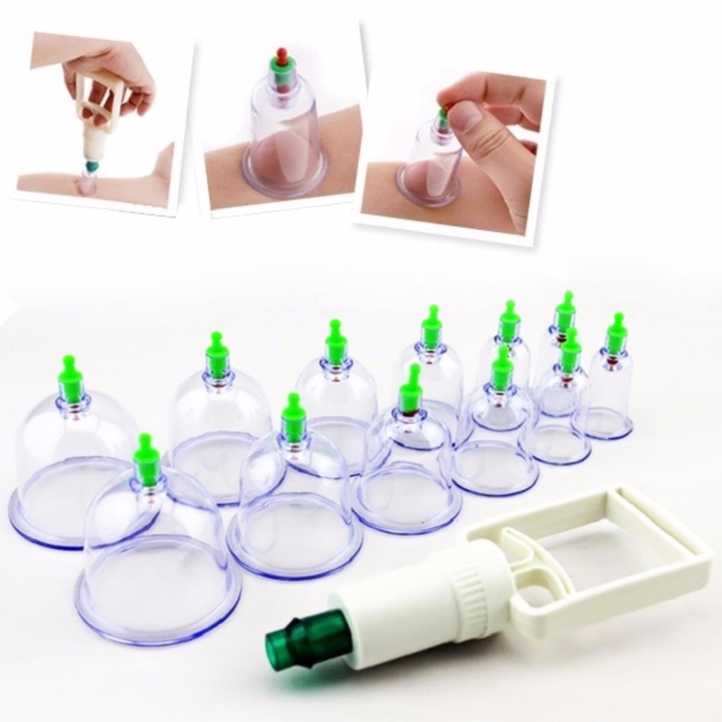 Hướng Dẫn Mua Bộ Giác Hơi Dùng Lửa Ở Đâu Uy Tín Và An Toàn