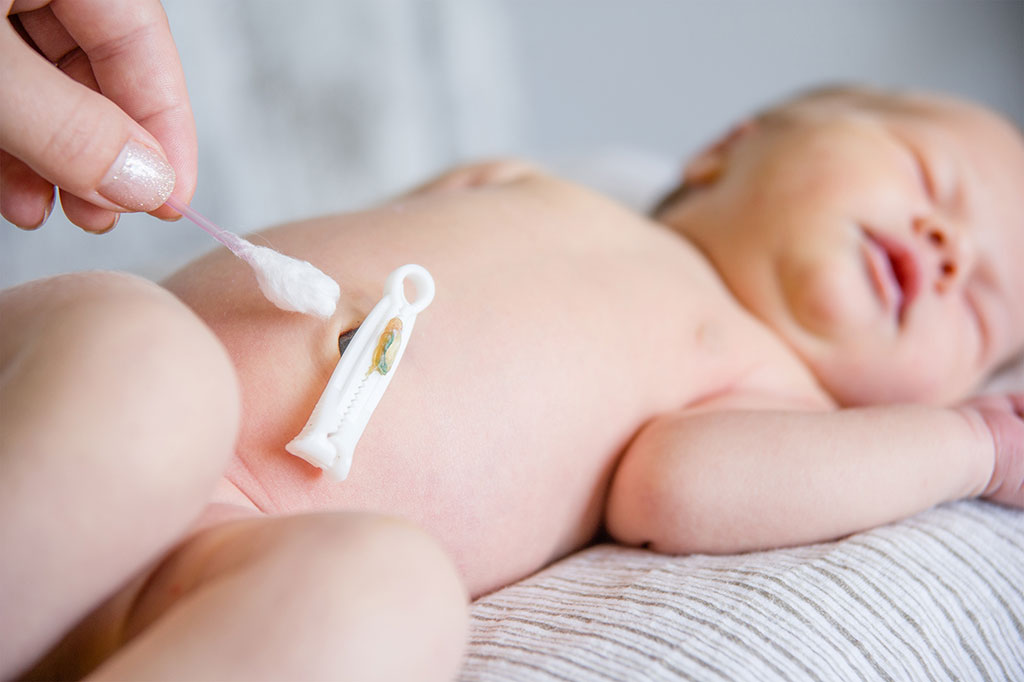 Chăm Sóc Rốn Bé Vừa Rụng: Giải Đáp Thoa Thuốc Sát Khuẩn & Lưu Ý