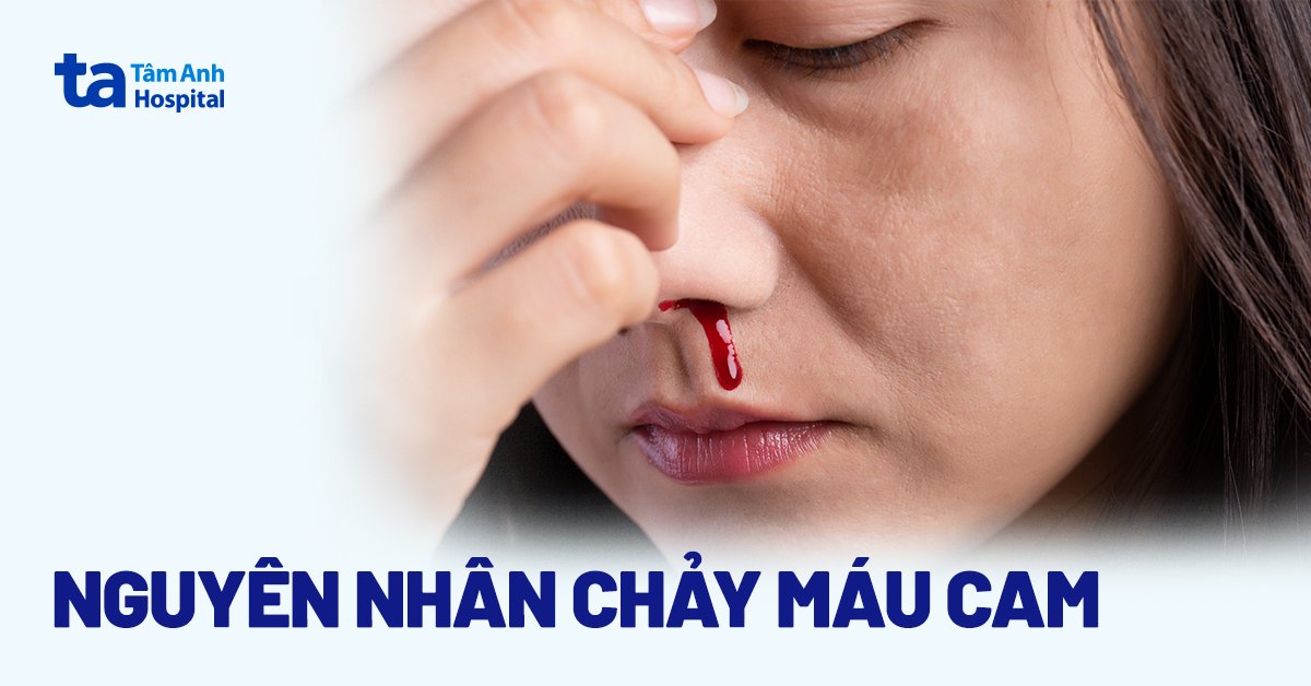 Chảy Máu Mũi Có Nguy Hiểm Không: Hiểu Rõ Nguyên Nhân và Cách Xử Lý