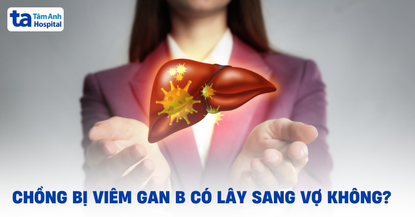 Uống thuốc gì khi viêm gan B chưa tấn công: Hướng dẫn điều trị và quản lý