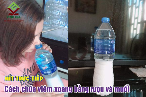 Trị Viêm Xoang Bằng Muối Và Rượu: Hướng Dẫn Chi Tiết A-Z