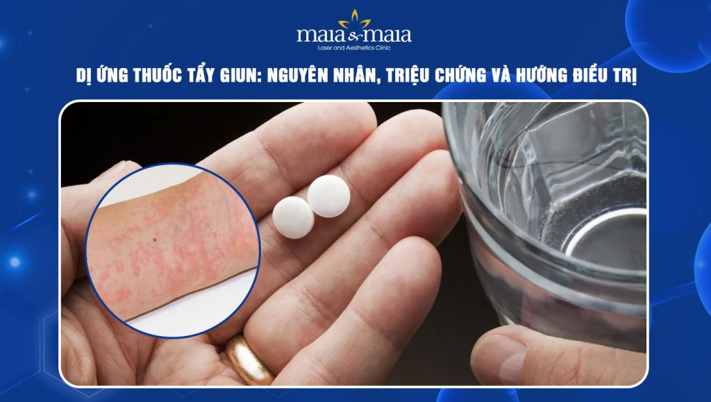 Trẻ Em Uống Thuốc Giun Fukaka Bị Dị Ứng Thuốc: Nguyên Nhân Và Cách Xử Lý An Toàn